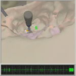 video of
temporal bone surgical simulator