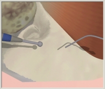 image of temporal bone surgical simulation
