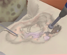 image of temporal bone surgical simulation